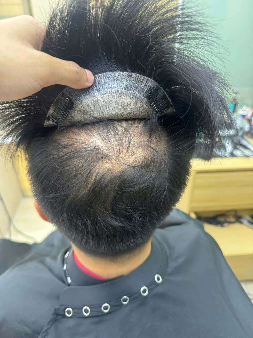 Before